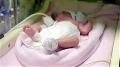 أغرب ولادة طفل بالعالم في بني سويف.. أخصائي نساء يكشف التفاصيل (فيديو)