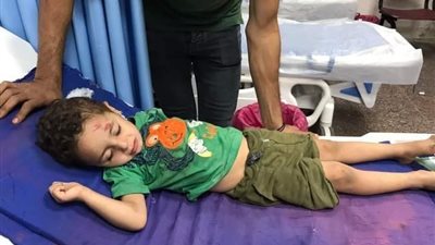 إصابة طفل في حادث 