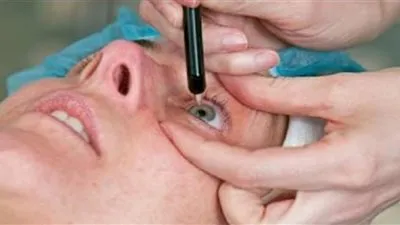 تصيب بالعمى.. طلب إحاطة لوزيرة الصحة لوقف عمليات تغيير لون العيون