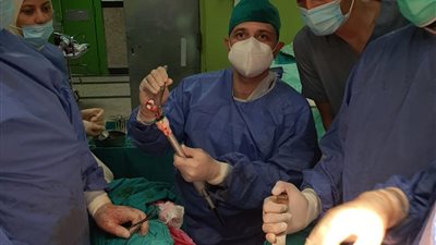 مستشفى منشية البكري بالقاهرة يجري استئصال ورم خبيث من القولون لمريض 68 عامًا