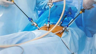 تحذير من استشاري جراحة السمنة بشأن زيادة محيط البطن (فيديو)