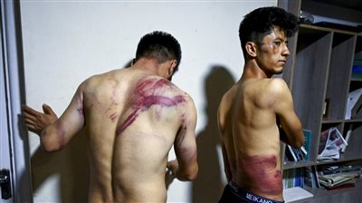 قصص مأساوية عاشها الشعب الأفغاني بعد حكم طالبان 