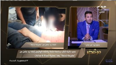 فريق طبي بجامعة طنطا ينقذ يد عامل من مفرمة لحمة.. شاهد التفاصيل 