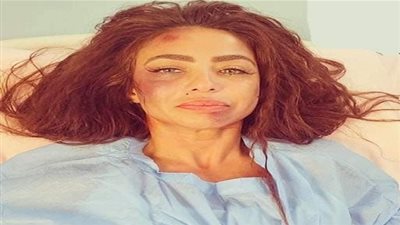 ماذا حدث للفنانة دوللي شاهين بعد تعرضها للضرب من بلطجية؟