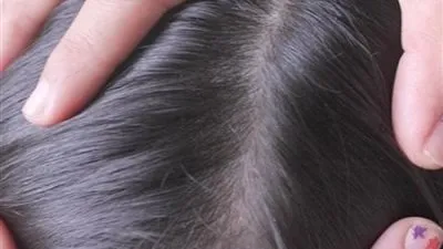 الخل والزيت.. هاني الناظر يوضح كيف يمكن التخلص من 