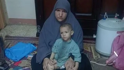 مرض نادر يصيب الأطفال.. تعرف على متلازمة 