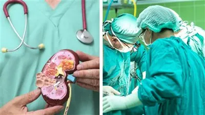 أستاذ مناعة يكشف تفاصيل نجاح أول جراحة لزرع كلية خنزير داخل جسم بشري