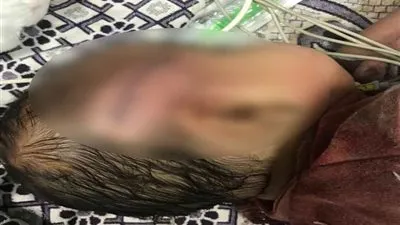 اعتدي علي طفلته بالساطور .. أب يتجرد من مشاعر الأبوة في المنوفية