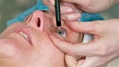 عضو بالشيوخ يكشف شروط التبرع بالقرنية (فيديو)