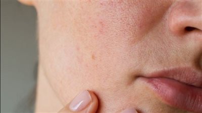 هاني الناظر يوجه نصائح للوقاية من أمراض جلدية بسبب الطقس البارد (فيديو)