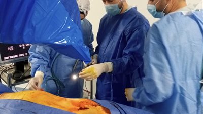 لأول مرة.. استخراج حصوة مرتجعة بحوض الكلى اليسرى بالسنبلاوين العام