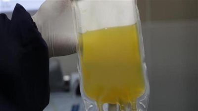  تفاصيل التبرع بالبلازما.. تعرف على الخطوات والشروط