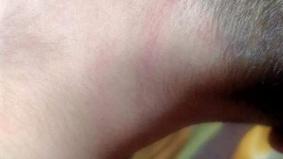 طالب يتهم والدته وزوجها العرفي بالاعتداء عليه بالضرب ببنها