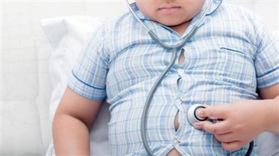 استشاري: السمنة تؤثر سلبيا على نفسية للطفل