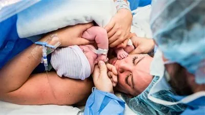 طبيب نساء يكشف السبب الحقيقي لارتفاع نسبة الولادة القيصرية بمصر (فيديو)