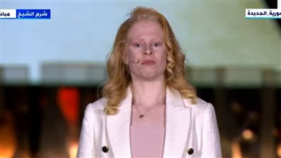  مصابة بمرض ضد الشمس توجه الشكر للرئيس: 