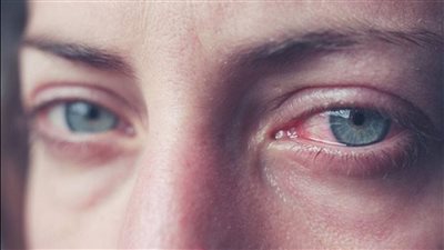 أستاذ فيروسات يكشف حقيقة تسبب 