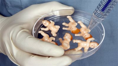 طبيب ذكورة يكشف عن سبب فشل الحقن المجهري