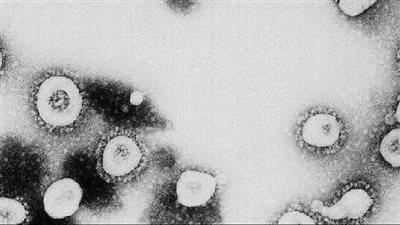 عاجل.. كوريا الجنوبية تسجل أعلى حصيلة إصابات يومية بكورونا