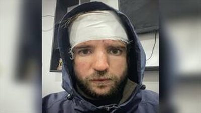 تعرف على قصة الاعتداء على الصحفي الروسي داخل حي الزبالين بمنشية ناصر (تفاصيل)