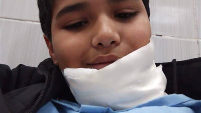  طالب يعتدي على زميله بالصف السادس الابتدائي ويصيبه بـ100غرزة بالإسكندرية 