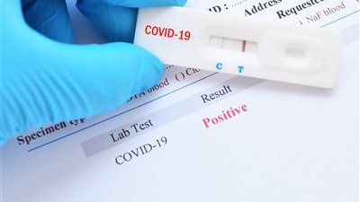 مقترح برلماني باعتماد بيع الكاشف السريع rapid test بالصيدليات للكشف كورونا