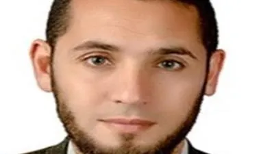 تطوير سبائك لصناعة أجزاء لجسم الانسان.. إنجاز علمي جديد بالجامعة اليابانية