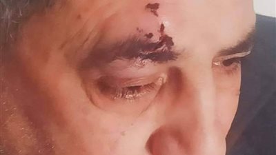 التحقيق في واقعة تعد ولي أمر على مدرس بشبين القناطر