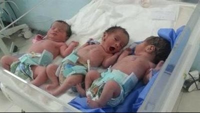 الرعاية الصحية: نجاح ولادة 3 توائم لسيدة حامل بعد تعرضها لتأخر الإنجاب