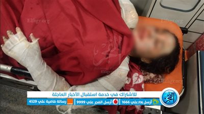 ننفرد بنشر صور لسيدة أشعل زوجها النار في جسدها بمنشأة القناطر