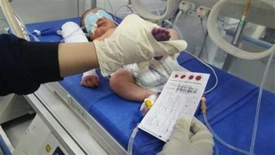 مدير الكشف المبكر على الأمراض الوراثية: المبادرة تهدف لمنع الإعاقة (فيديو)