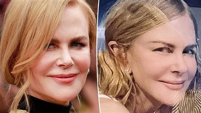 نيكول كيدمان تظهر بملامح مختلفة خلال تصوير مسلسلها الجديد