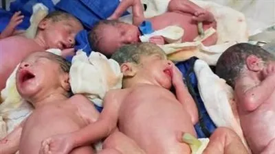 رئيس نساء وتوليد مستشفى المنشاوي بطنطا تكشف تفاصيل ولادة سيدة لـ 5 توائم (فيديو)