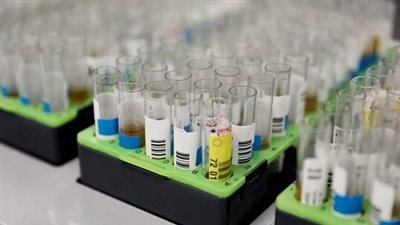 45 إصابة جديدة بجدري القردة في بريطانيا