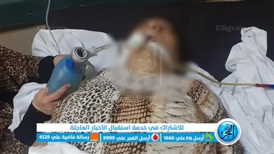 شاب يدهس ممرضة أمام مستشفى الصدر بدمنهور (صور)