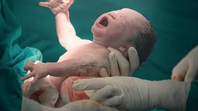 طبيب أمراض نساء يوضح تفاصيل اكتشاف سيدة لحملها لحظة الولادة (فيديو)