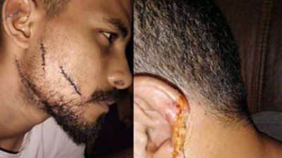 من معاكسة لـ 