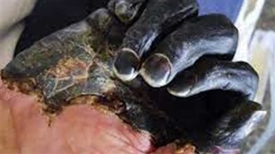 حقيقة انتشار وباء الموت الأسود في الصين (فيديو)