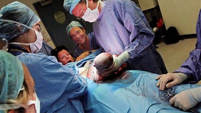 عضو بنقابة الأطباء يكشف أضرار الولادة القيصرية على الأم والجنين (فيديو)