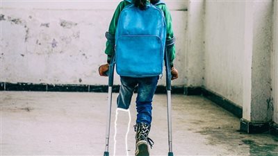 تسليم أجهزة تعويضية للمرضى غير القادرين بأسوان