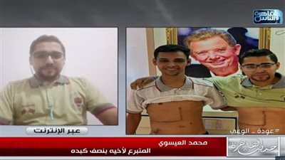 شقيقان بكبد واحد.. ابن الفيوم يتبرع بنصف كبده لإنقاذ حياة شقيقه