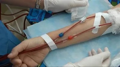 تصل إلى 500 جنيه.. التفاصيل الكاملة لزيادة سعر الغسيل الكلوي 