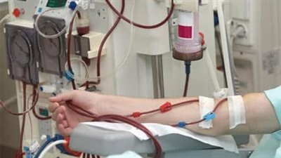 هل تم زيادة سعر الغسيل الكلوي؟.. متحدث 