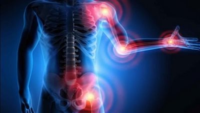 في اليوم العالمي لالتهاب المفاصل.. أبرز أسباب الإصابة وطرق العلاج