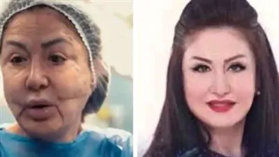 بعد تشويه وجهها.. قصة إنقاذ الممثلة وفاء سالم من الموت 