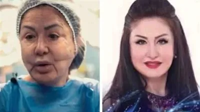 وفاء سالم تكشف تفاصيل وقوعها ضحية لعمليات التجميل