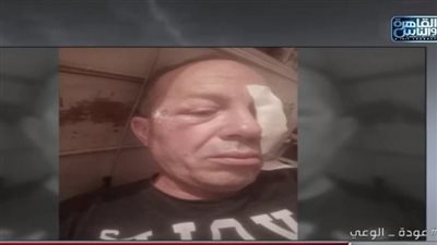 سائق قطار كفرالشيخ المصاب: قذفونا بالحجارة فكسروا زجاج القطار ودخل عيني