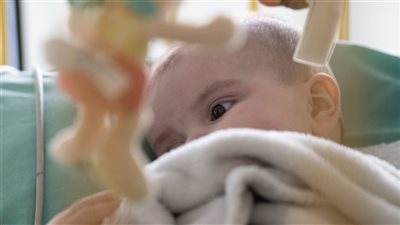 يصيب 73% من أطفال مصر.. ما هو الفيروس المخلوي التنفسي؟