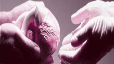 كل ما تريد معرفته عن نموذج التبرع بالأعضاء بعد الوفاة