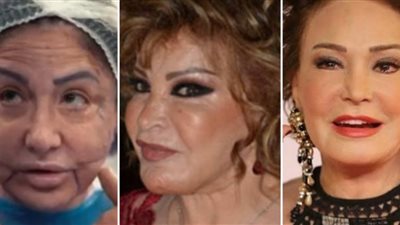 آخرهن وفاء سالم.. فنانات وقعن ضحايا فشل عمليات التجميل 